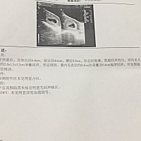 有会看的吗？ 昨天刚检查的