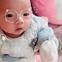 变成光头啦，洗澡的医生说头发不剃头上的皮洗不干净，留了发际线所以像戴了面具一样😄😄