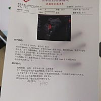 宝宝这样正常吗？ 有没有专业一点的大夫帮忙瞧瞧 ？ 宝宝现在36 6