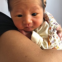 孩子黄疸高，我是o型血，老大就高，我该怎么办，实在舍不得让他照蓝光，感觉好受罪，