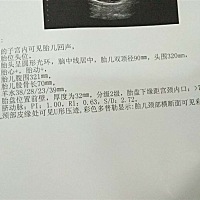 34 5做的b超，帮忙看看宝宝有多少斤了，谢谢