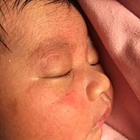 宝宝出生17天了，最近发现脸上长了些小红点点是怎么回事啊，是湿疹嘛