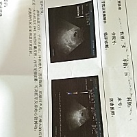 这个孕囊是属于圆的吗