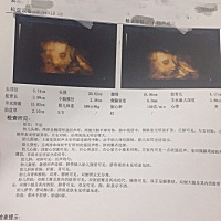 已知男女，大家猜猜看