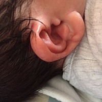 宝宝还没满月耳朵上这里肿起来了，是怎么回事？有知道的宝妈吗？