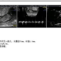 NT顺利通过谁会看的是男还是女