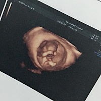 一胎时忌口。二胎不忌口～出生后比姐姐还白😄