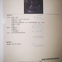 大家帮忙看下是男孩还是女孩😄😄😄😄