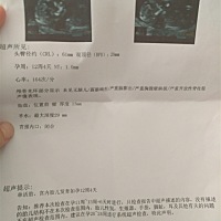 今天NT顺利通过