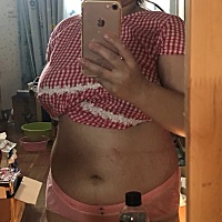 宝子两个月半 恢复慢 不急 胖就胖吧