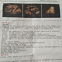 请各位美女宝妈们，无聊猜猜男女！❤️❤️❤️