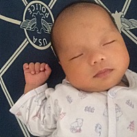 宝宝出生十几天额头上长了一块类似胎记的暗影，现在小孩三个月了，暗影还在，貌似暗影会随着小孩的长大...