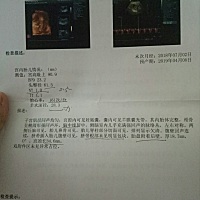 能看出男宝女宝吗？大家来猜猜，nt单子顺利通过！