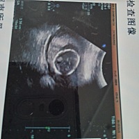 厉害的宝妈们，帮忙看看是男孩女孩?