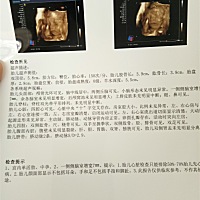 大家帮忙看看是男是女？？