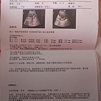 20周啦！双胎小棉袄！你们一定要健健康康平平安安。都要过五斤，我们过完年见吧。！