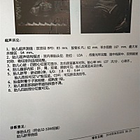 谁能告诉我是男孩女孩😜😜😜