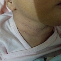 长的是什么啊，湿疹吗