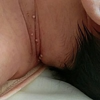 宝宝三天了，这是怎么回事？你们谁见过呀