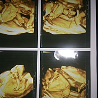 宝宝5个月了，也越来越活越了，一到下午就在肚子里练拳呢，你们能看出来是女宝宝还是男宝宝吗？