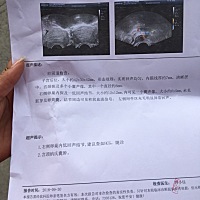 各位宝妈们请帮忙给我看一下胎儿能不能要，