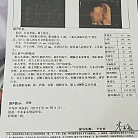 前几天去做的四维彩超