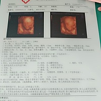 亲们能看的出来男孩女孩吗