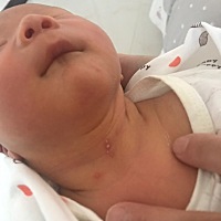 各位宝妈，有没有这种情况的，白色的泡泡，在医院洗完澡回来就出来了，这是什么？