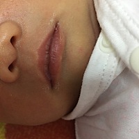 宝妈们，宝宝的嘴唇起了好几个泡，可能吃饭放了一点盐，但是从今天开始不放盐了，有经验的宝妈们，这个...