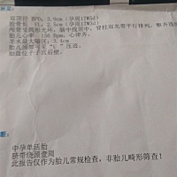宝妈们，你们有没有胎儿颈部有u型压迹的？好怕唐筛过不了？昨天刚查的唐筛，医生说等唐筛结果出来不过关...