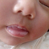 新生儿宝宝，嘴皮干干的，正常嘛，用不用管它，还是有什么办法去皮