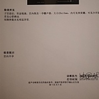 宝妈们帮我看下这孕囊是什么形状！是前壁吗？