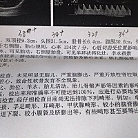 36周 6做的B超，医生说宝宝头偏大，腿偏短，有没有一样的宝妈，有点担心