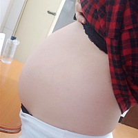 希望自己不要长妊娠纹