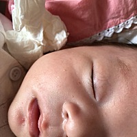 看看我家宝宝脸上起的那是什么？