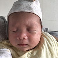 宝宝最近脸上长了很多这样的东西，到底是怎么了？要不要去医院检查一下呢？