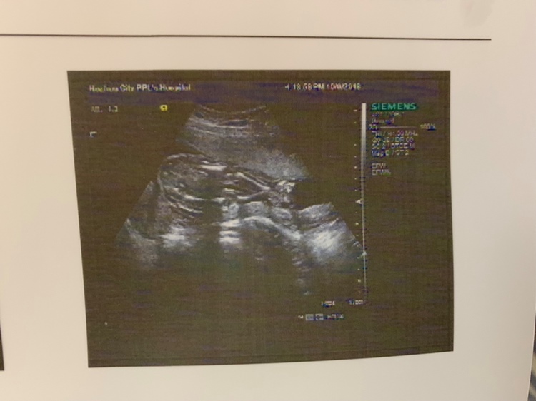 听说这是腿，中间是蛋蛋，有没有人看得懂？