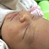 有没有懂的宝妈们帮忙给看看宝宝的脸