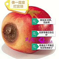 💟 正常的宫颈光滑如初 一旦有了炎症引起糜烂 宫颈就会像苹果一样快速糜烂👇🏻👇🏻