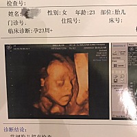 宝宝出生了 发个🅱️超图对比一下 还有六天就满月啦 月子里只有自己和老公两个新手妈妈爸爸 每天...