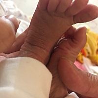 顺转剖的痛永生难忘😣三年以后也希望自己再多添一位公子，不要女儿，太痛苦啦