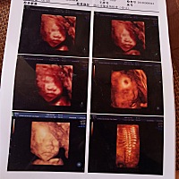 大家帮我看看像不像孩子它爸