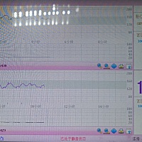34周➕3⃣ 第一次开始做胎心监测宝宝是不有点不适应，一直在动😀