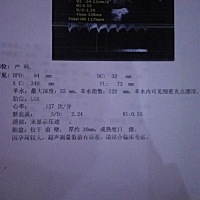 检查羊水有点浑浊，不阵痛，也不见红，医生说让住院观察，还是等肚疼了再去？