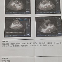 能看出男孩女孩吗？