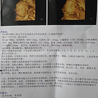 今天去照三维彩超看到宝宝了，好开心……很好奇是男宝还是女宝，圈圈的宝妈们能帮看下吗😊