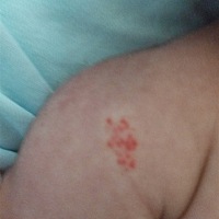 不知道宝宝手哪里长的什么，出生时没有，后面的几天发现的还以为是胎记呢，但是还长的了一点，帮忙看一...