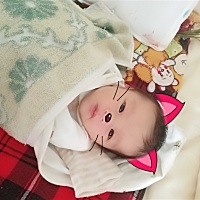 有没有知道眼皮上面红一块怎么回事，有时候明显有时候不明显