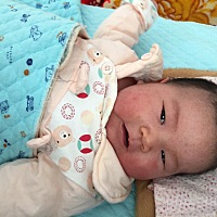 闺女脸上都是疙瘩头上也是。有人遇见这种情况吗 怎么办 帮忙支支招