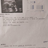 头胎，好奇男女，宝妈们帮我看看！